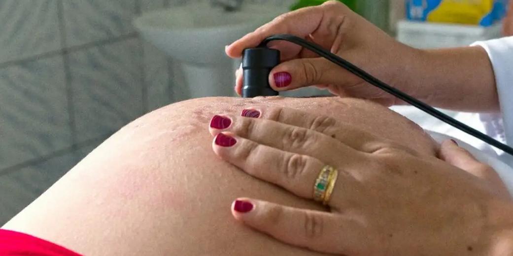 Cinco hospitais de SP devem comprovar cumprimento da decisão que liberou a realização da assistolia fetal para interrupção de gravidez (MDS / arquivo)