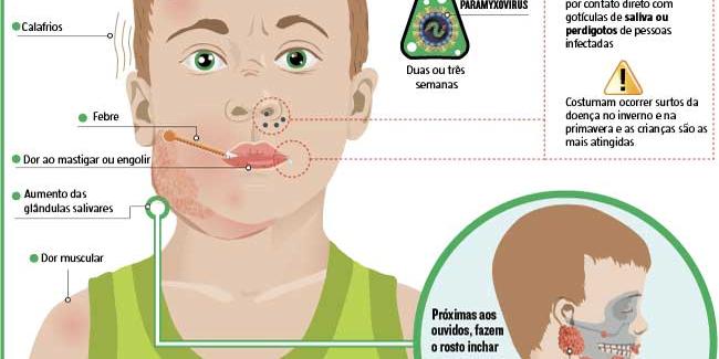 Caxumba: Entenda a doença - Globalmed Clínica