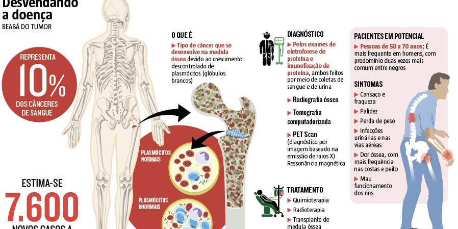 eletroforese mieloma múltiplo