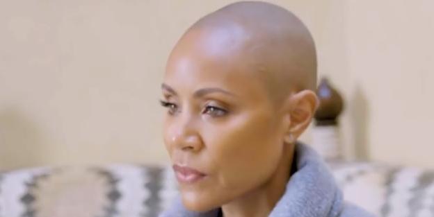 A atriz Jada Pinkett Smith mantém a cabeça raspada por ser vítima da alopecia areata (Reprodução / Redes Sociais Jada Pinkett Smith)